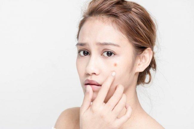 Công dụng và thành phần Zinc For Acne trị mụn mà bạn nên biết 6 zinc for acne trị mụn review