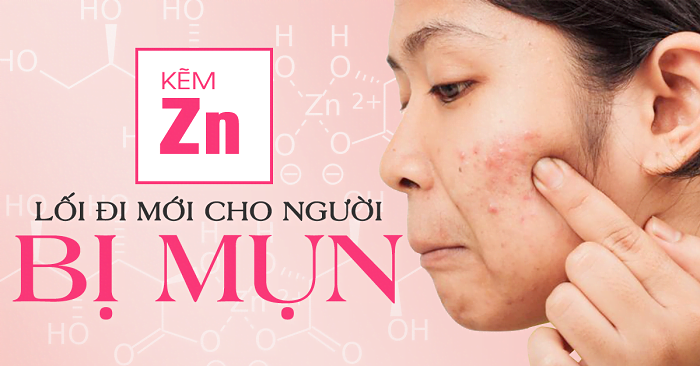 Zinc For Acne tai shop Zinc For Acne