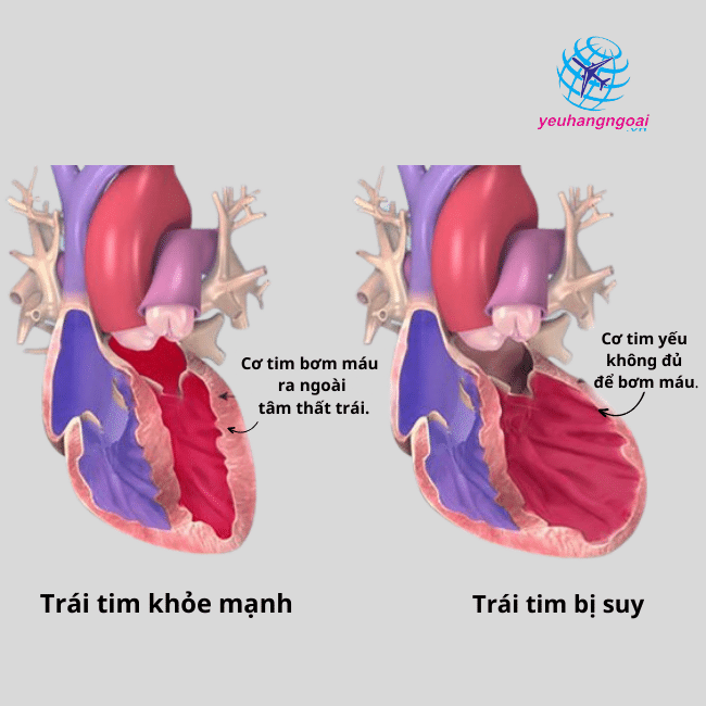 Coq10 là thuốc gì? Công dụng? Top 7 thuốc bổ tim tốt nhất hiện nay 10 Doi tuong nao can bo sung Coq10
