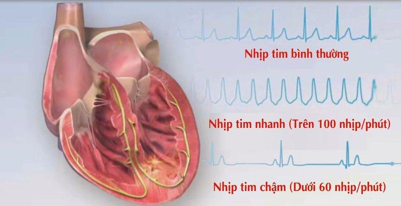 Các bệnh tim mạch thường gặp nhất và cách chữa bệnh tim mạch hiệu quả 19 các bệnh tim mạch phổ biến