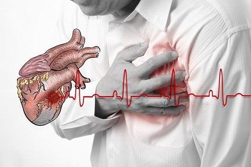 Các bệnh tim mạch thường gặp nhất và cách chữa bệnh tim mạch hiệu quả 17 các bệnh tim mạch