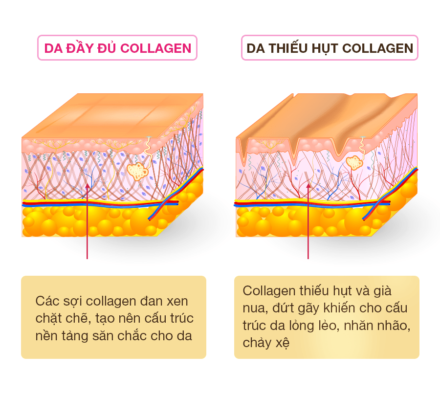 Cac loai Collagen - Cau truc cua no la gi